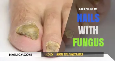 Polishing Nails with Fungus: Safe Practice or Risky Move?