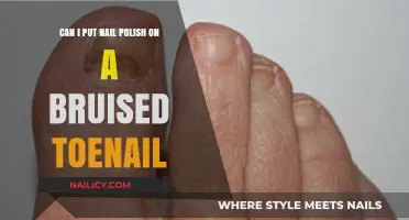 Nail Polish on Bruised Toenails: Safe or Risky? Expert Tips