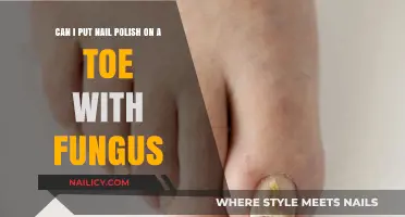 Nail Polish on Fungal Toes: Safe or Risky Choice?