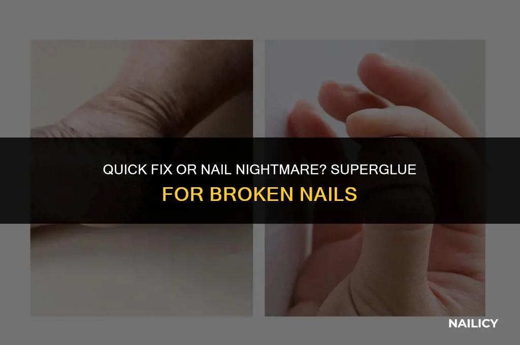 can i put superglue on my broken nail