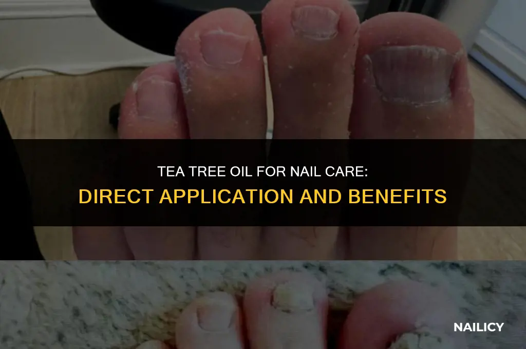 can i put tea tree oil directly on my nail