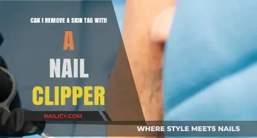 Trimming Skin Tags: Nail Clippers – Safe or Not?