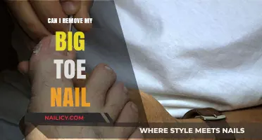 Toe-nail Troubles: Should You Remove Your Big Toe Nail?
