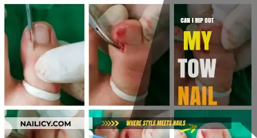 Ouch! Can I Really Rip Out My Ingrown Toenail?