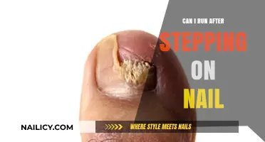 Ouch! Can I Run After Stepping on a Nail?