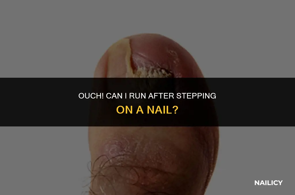 can i run after stepping on nail