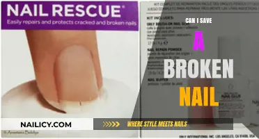 Nail Rescue: Tips to Save a Broken Nail and Keep It Healthy