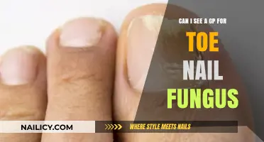 Treating Toenail Fungus: When to See a GP for Effective Care