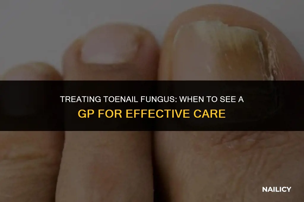 can i see a gp for toe nail fungus
