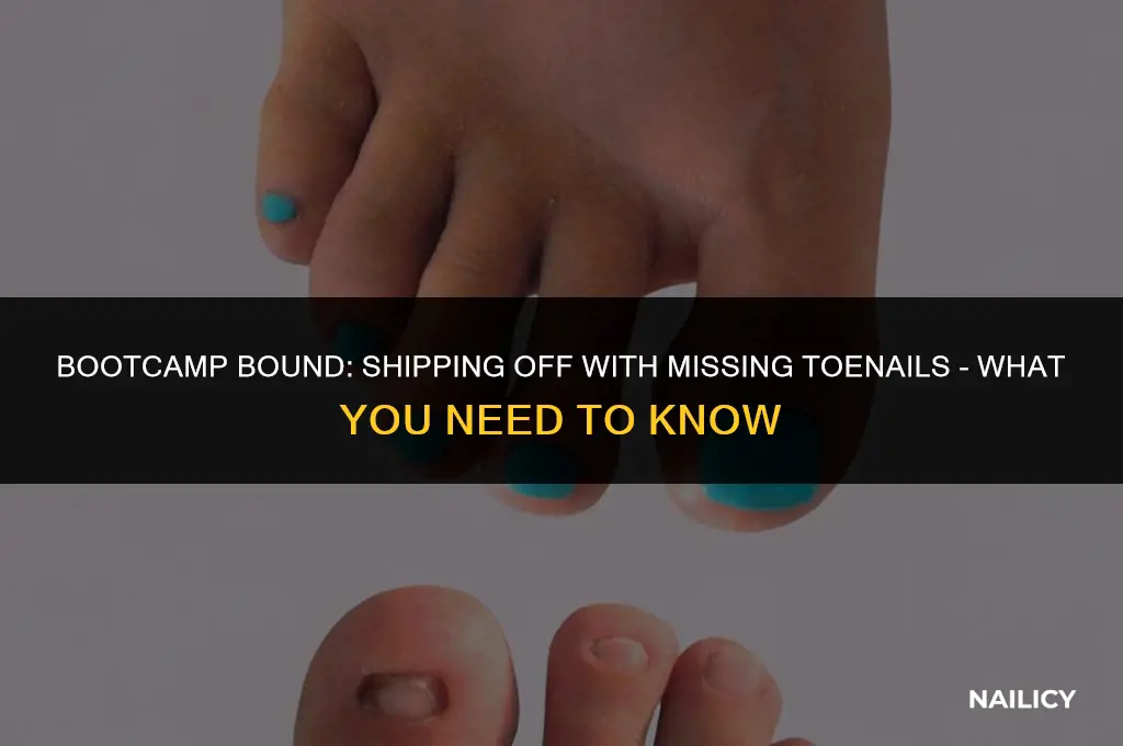 can i ship to bootcamp with missing toe nails