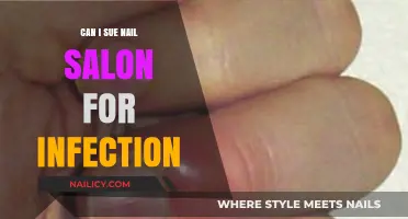 Legal Options for Nail Salon Infections: What You Need to Know