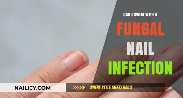 Swimming with a Fungal Nail Infection: What You Need to Know