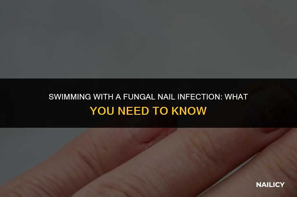 can i swim with a fungal nail infection
