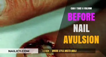 Pre-Nail Avulsion Anxiety: Is Valium a Safe Option?