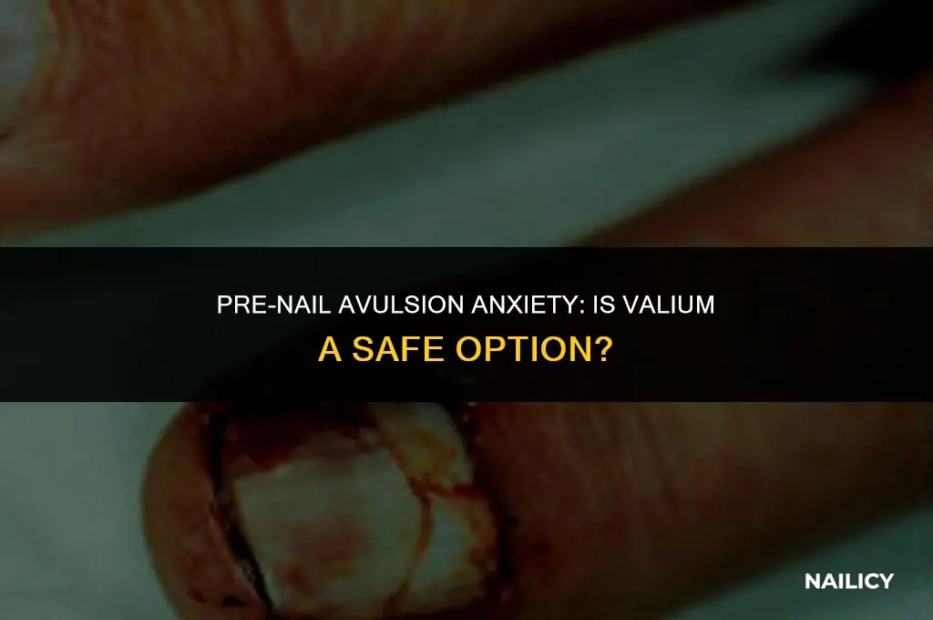 can i take a valium before nail avulsion