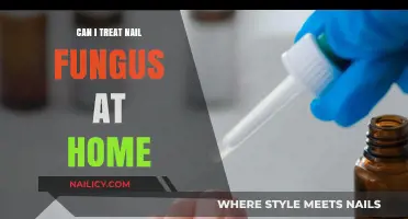 Effective Home Remedies to Treat Nail Fungus Naturally