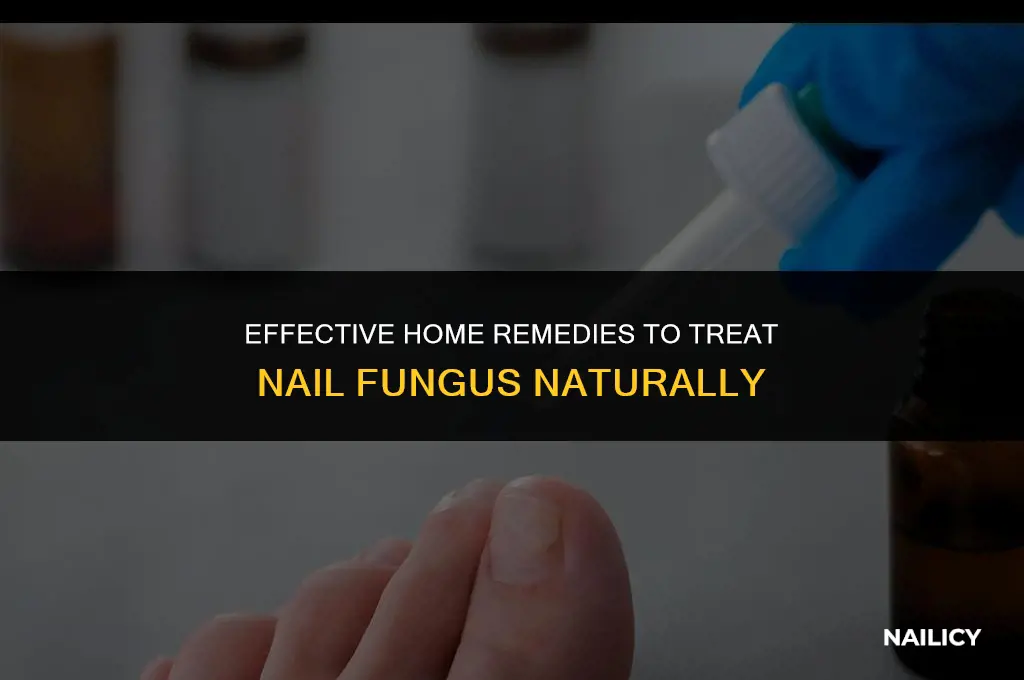 can i treat nail fungus at home