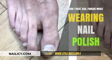 Treating Nail Fungus: Can You Keep Your Polish On?