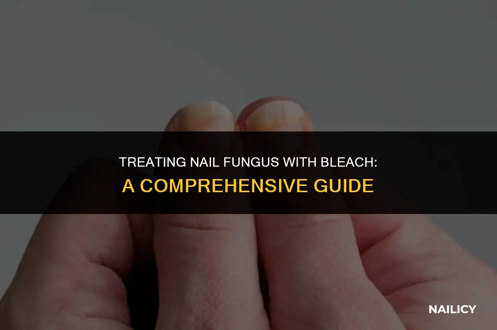 can i treat nail fungus with bleach