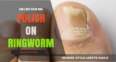 Clear Nail Polish for Ringworm: Safe Treatment or Harmful Myth?