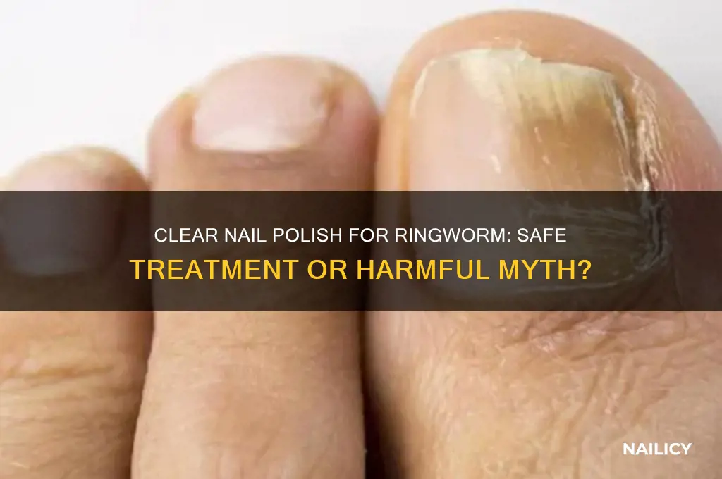 can i use clear nail polish on ringworm