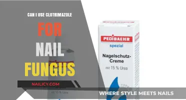 Treating Nail Fungus: Is Clotrimazole the Right Solution?