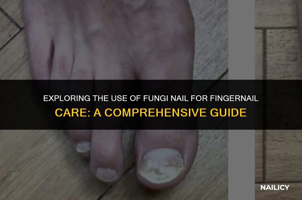 can i use fungi nail on my fingernails