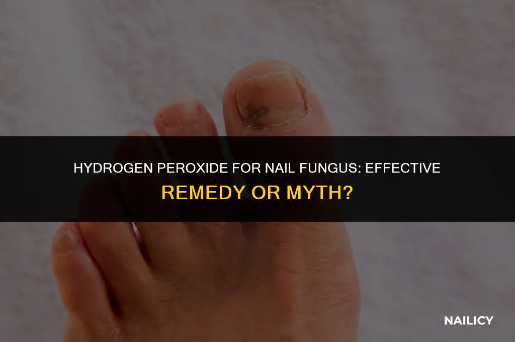 can i use hydrogen peroxide for nail fungus