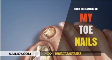 Treating Toenail Fungus: Is Lamisil the Right Solution?