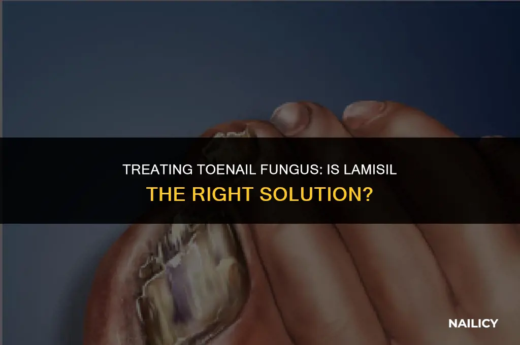 can i use lamisil on my toe nails