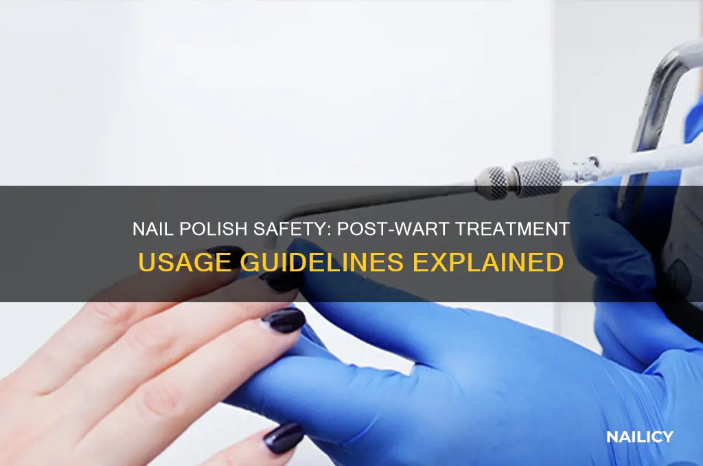 can i use my nail polish after treating warts