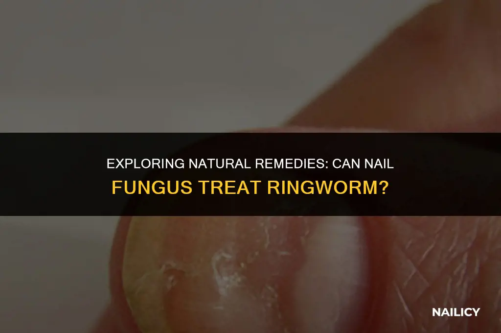 can i use nail fungus for ringworm