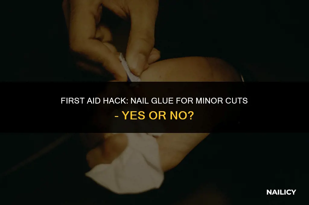 can i use nail glue to close a cut
