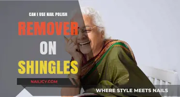 Using Nail Polish Remover on Shingles: Is It Safe?