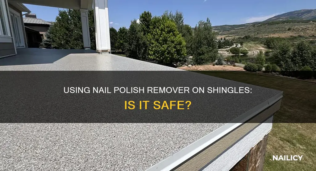 can i use nail polish remover on shingles