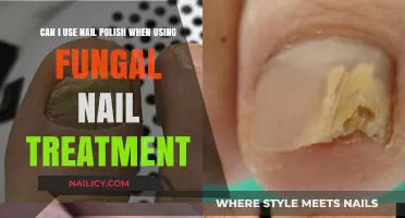 Nail Polish and Fungal Treatment: Can They Coexist Safely?