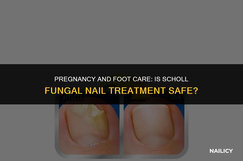 can i use scholl fungal nail treatment when pregnant