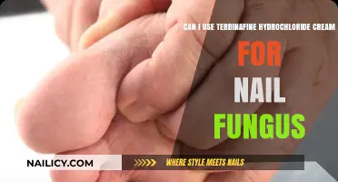 Treating Nail Fungus: Is Terbinafine Hydrochloride Cream Effective?