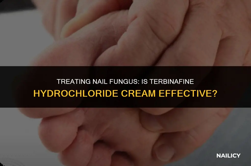 can i use terbinafine hydrochloride cream for nail fungus