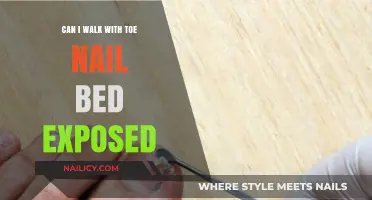 Walking with Exposed Toenail Bed: Risks and Remedies