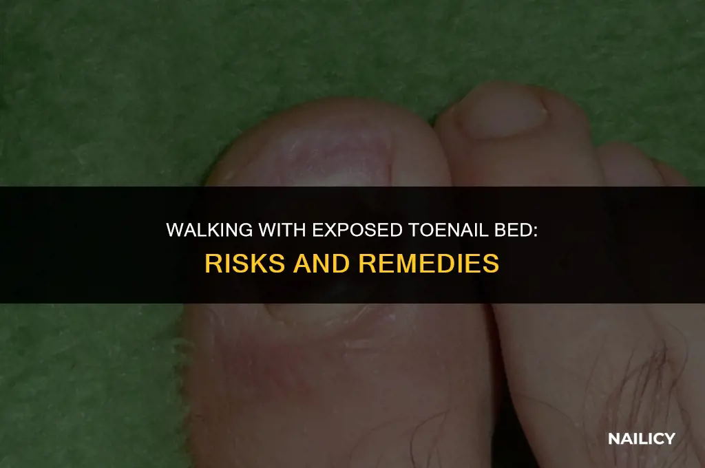 can i walk with toe nail bed exposed