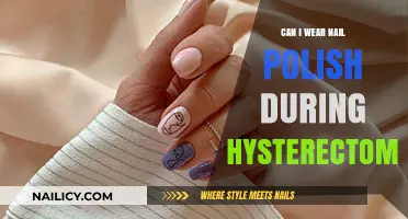 Nail Polish and Hysterectomy: Pre-Surgery Guidelines You Need to Know