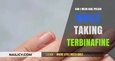 Nail Polish and Terbinafine: Safe to Wear During Treatment?
