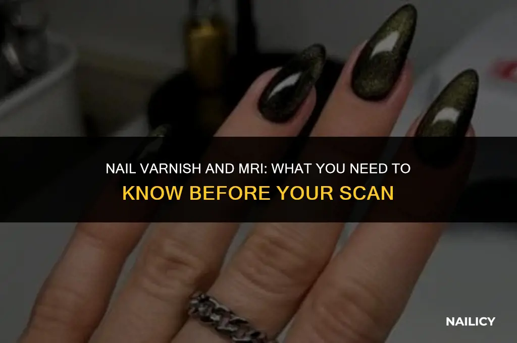 can i wear nail varnish for an mri