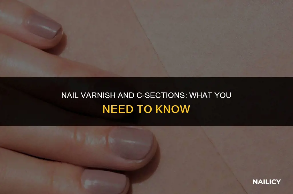 can i wear nail varnish for c section