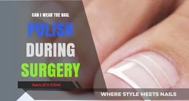 Toe Nail Polish and Surgery: What You Need to Know