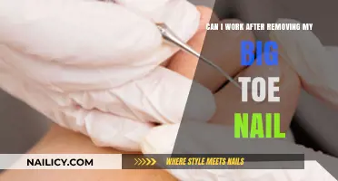 Toe Nail Removal: Can You Work?