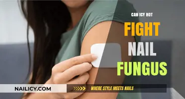 Combating Nail Fungus: The Icy Hot Solution Explored