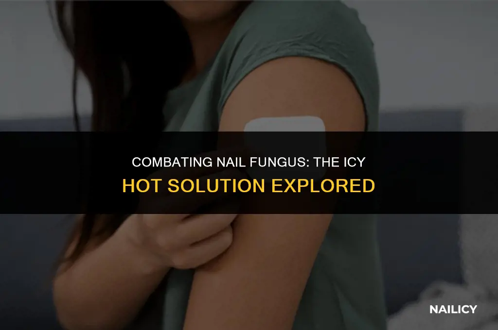 can icy hot fight nail fungus