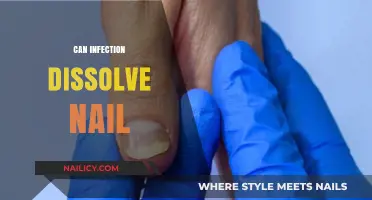 Exploring the Myths: Can Infections Really Dissolve Your Nails?